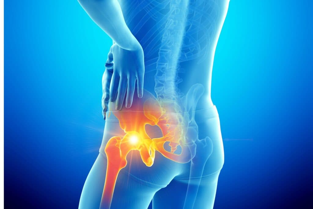 Hip Pain Therapy - Davis County